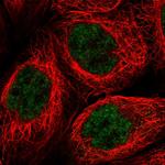 PRELID2 Polyclonal Antibody