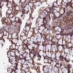 PRELID2 Antibody in Immunohistochemistry (Paraffin) (IHC (P))