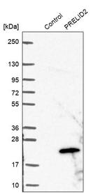 PRELID2 Antibody in Western Blot (WB)