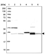NIPSNAP3A Antibody in Western Blot (WB)