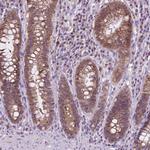 TTC9B Polyclonal Antibody