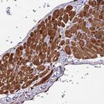 ESCO1 Polyclonal Antibody