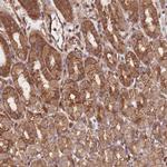 CCDC140 Polyclonal Antibody