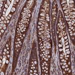 CACTIN Polyclonal Antibody