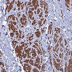 RAB39A Polyclonal Antibody