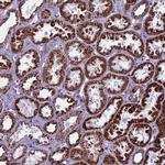 ICA1L Antibody in Immunohistochemistry (Paraffin) (IHC (P))