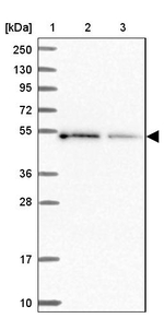 ICA1L Antibody in Western Blot (WB)