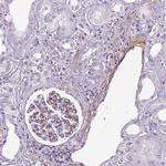 ATP10A Polyclonal Antibody