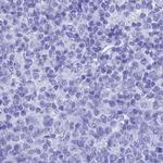 TEX101 Antibody in Immunohistochemistry (IHC)
