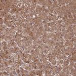 C2orf91 Antibody in Immunohistochemistry (Paraffin) (IHC (P))