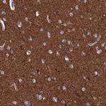 CEND Antibody in Immunohistochemistry (IHC)