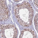 CENPV Antibody in Immunohistochemistry (IHC)