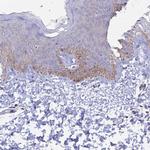 CENPV Antibody in Immunohistochemistry (IHC)