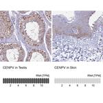 CENPV Antibody