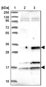 CENPV Antibody in Western Blot (WB)
