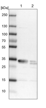 CENPV Antibody in Western Blot (WB)