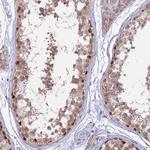 CENPV Polyclonal Antibody