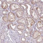 ZDHHC1 Antibody in Immunohistochemistry (Paraffin) (IHC (P))