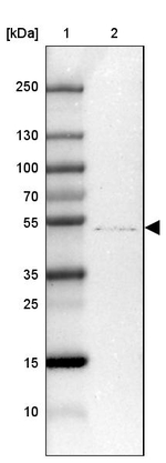 ZDHHC1 Antibody in Western Blot (WB)