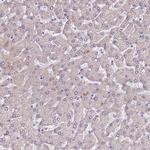 AKAP8L Antibody in Immunohistochemistry (IHC)