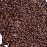 CACTIN Antibody in Immunohistochemistry (Paraffin) (IHC (P))