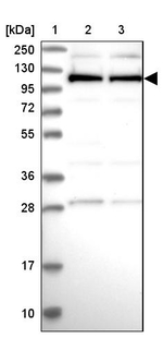 CACTIN Antibody in Western Blot (WB)