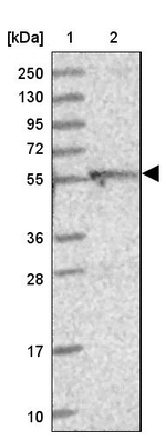 DUS2L Antibody in Western Blot (WB)
