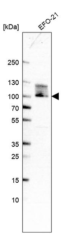 TBL3 Antibody in Western Blot (WB)