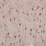 TAPT1 Antibody in Immunohistochemistry (Paraffin) (IHC (P))