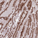 H3F3A Antibody in Immunohistochemistry (Paraffin) (IHC (P))