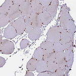 H3F3A Antibody in Immunohistochemistry (Paraffin) (IHC (P))