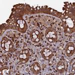 ERMAP Polyclonal Antibody