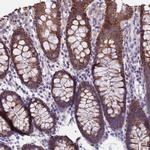 UQCRH Antibody in Immunohistochemistry (Paraffin) (IHC (P))