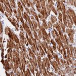 UQCRH Polyclonal Antibody