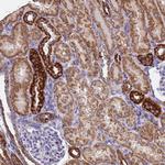 UQCRH Antibody in Immunohistochemistry (Paraffin) (IHC (P))