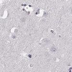 TCHHL1 Antibody in Immunohistochemistry (IHC)