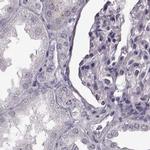 TCHHL1 Antibody in Immunohistochemistry (IHC)