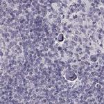 TCHHL1 Antibody in Immunohistochemistry (IHC)