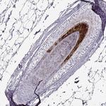 TCHHL1 Antibody in Immunohistochemistry (IHC)