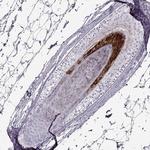 TCHHL1 Antibody in Immunohistochemistry (IHC)