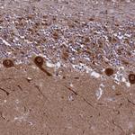 NDUFS5 Polyclonal Antibody