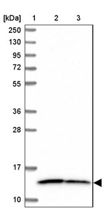 NDUFS5 Antibody in Western Blot (WB)