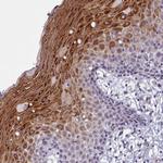 DEFB108B Antibody in Immunohistochemistry (Paraffin) (IHC (P))