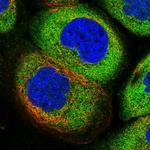 AdoHcyase 2 Polyclonal Antibody