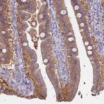 AdoHcyase 2 Antibody in Immunohistochemistry (Paraffin) (IHC (P))
