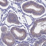 AdoHcyase 2 Antibody in Immunohistochemistry (Paraffin) (IHC (P))