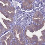 AdoHcyase 2 Antibody in Immunohistochemistry (Paraffin) (IHC (P))