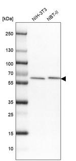 AdoHcyase 2 Antibody in Western Blot (WB)