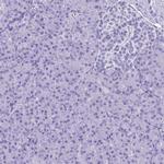 SLC7A9 Antibody in Immunohistochemistry (Paraffin) (IHC (P))