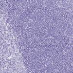 SLC7A9 Antibody in Immunohistochemistry (Paraffin) (IHC (P))